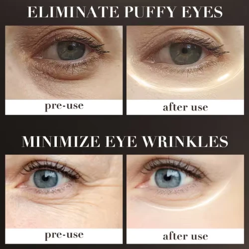 Eyes Care Cream With Massager Anti-wrinkle Dark Circle Removal Retinol Fade Mois