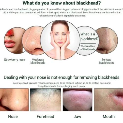 120ML Shrink Pores Skin Care Moisturizing Black Mask, Blackhead Whitening Comple