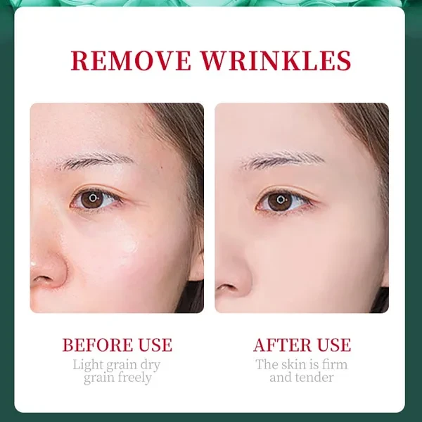 Sadoer Retinol Skin Repair Acne Revitalizing Face Serum For Women And Girl 30ml