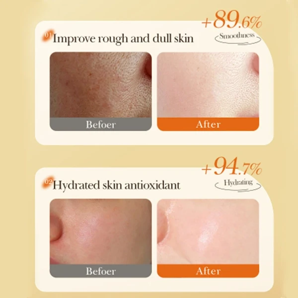 Anti Oxidation Acne Skin Repair Turmeric Face Mask Enhance Glow Skin Care Soothi