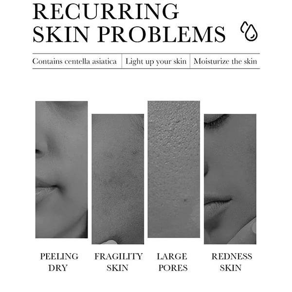 Centella Asiatica Anti-Acne Oil Control Personal Care Nourish Skin Repair Face C