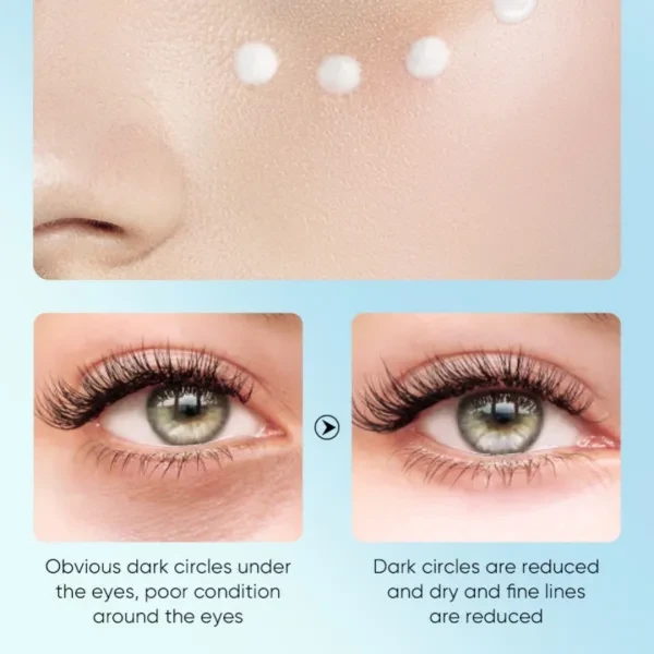 Aloe Vera Hydrate Moisturize Eye Cream Anti Dark Circles Eye Serum Remove Eye Ba