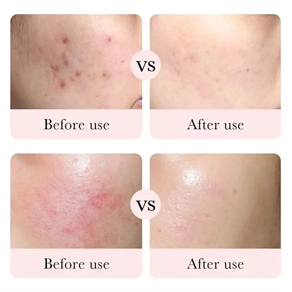 Camellias Facial Care Glowing Skin Enhancer Anti-Oxidation Personal Care Moist R