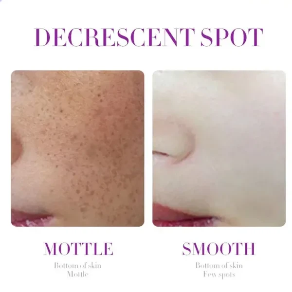 Nicotinamide Whitening Moisturizing Lotion Facial Cream Brightening Skin Dark Sp