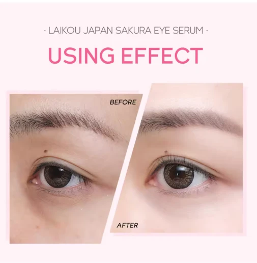LAIKOU Sakura Eye Serum Eye Roller Massage Vitamin C Hyaluronic Acid Skin Care E