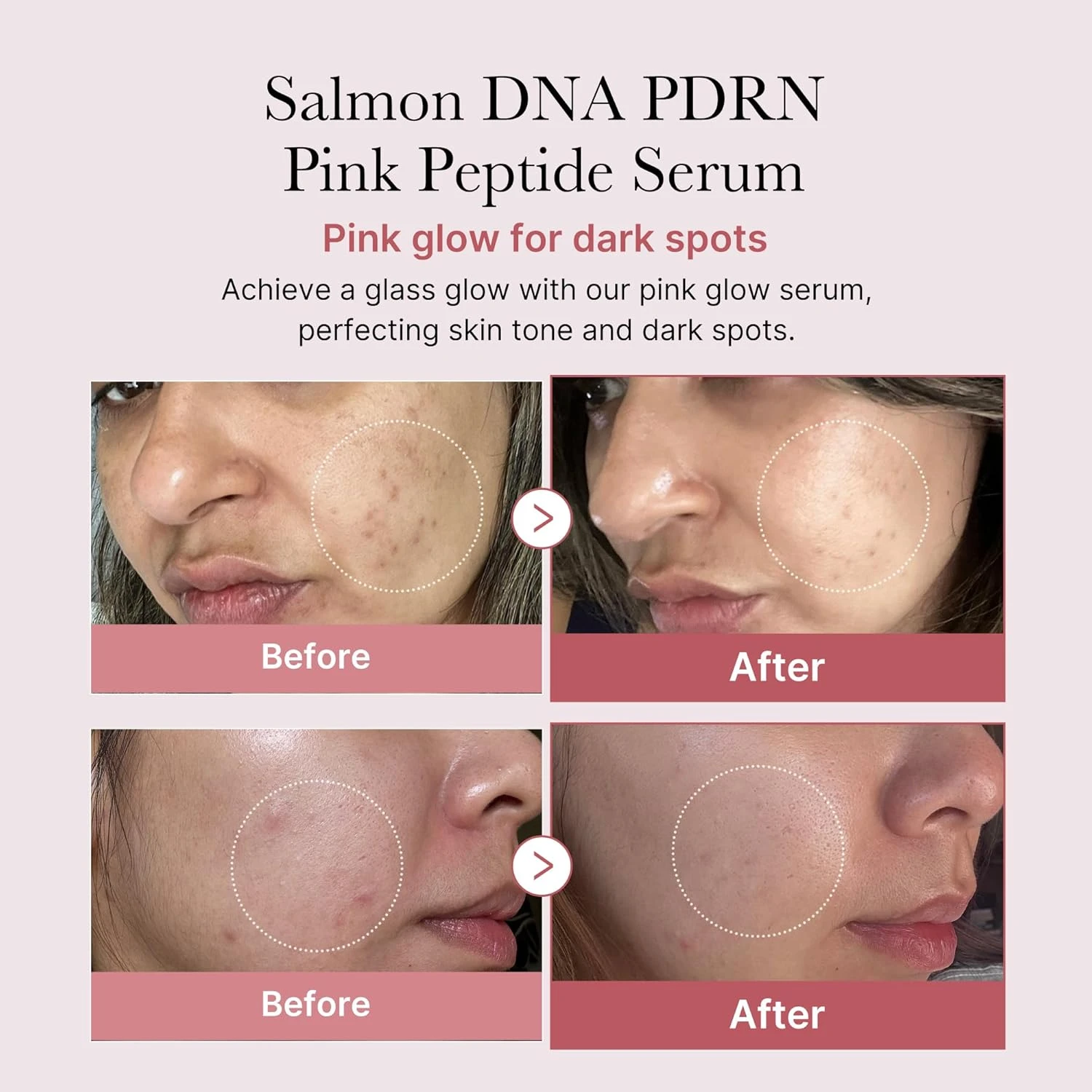 medicube Salmon DNA PDRN Pink Peptide Serum, Pink glow serum, Peptide, Niacinami