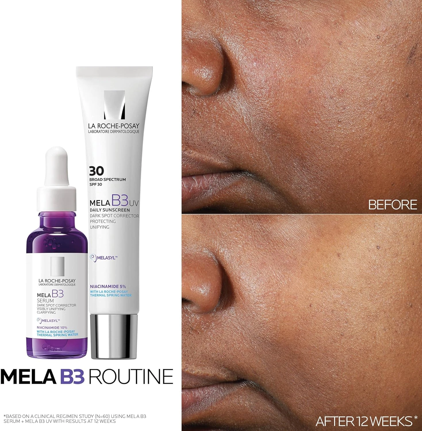 La Roche-Posay Mela B3 Concentrated Anti-Stain Intensive Anti-Reappearance Serum