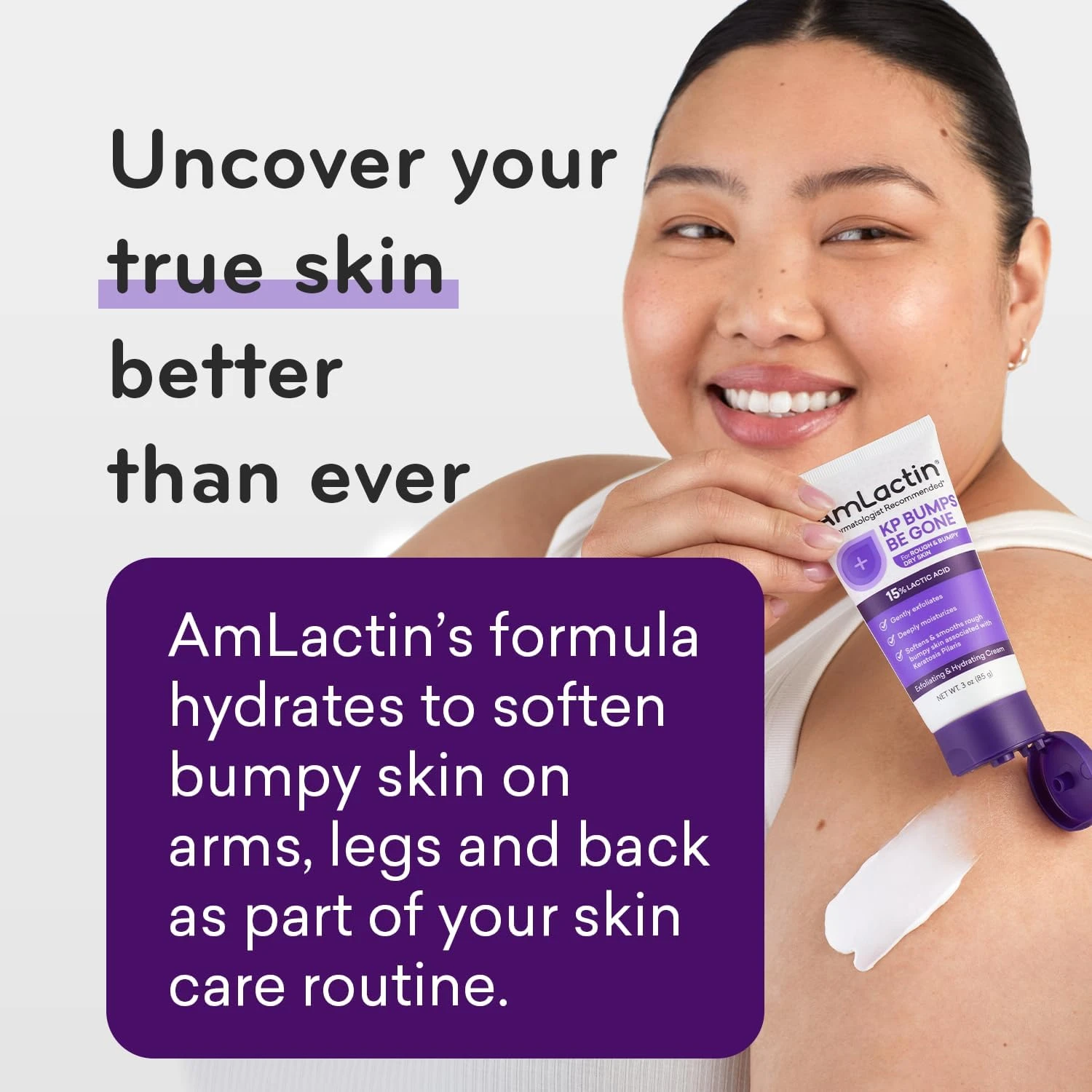 AmLactin KP Bumps Be Gone - 3 oz Keratosis Pilaris Moisturizing Cream with 15% L