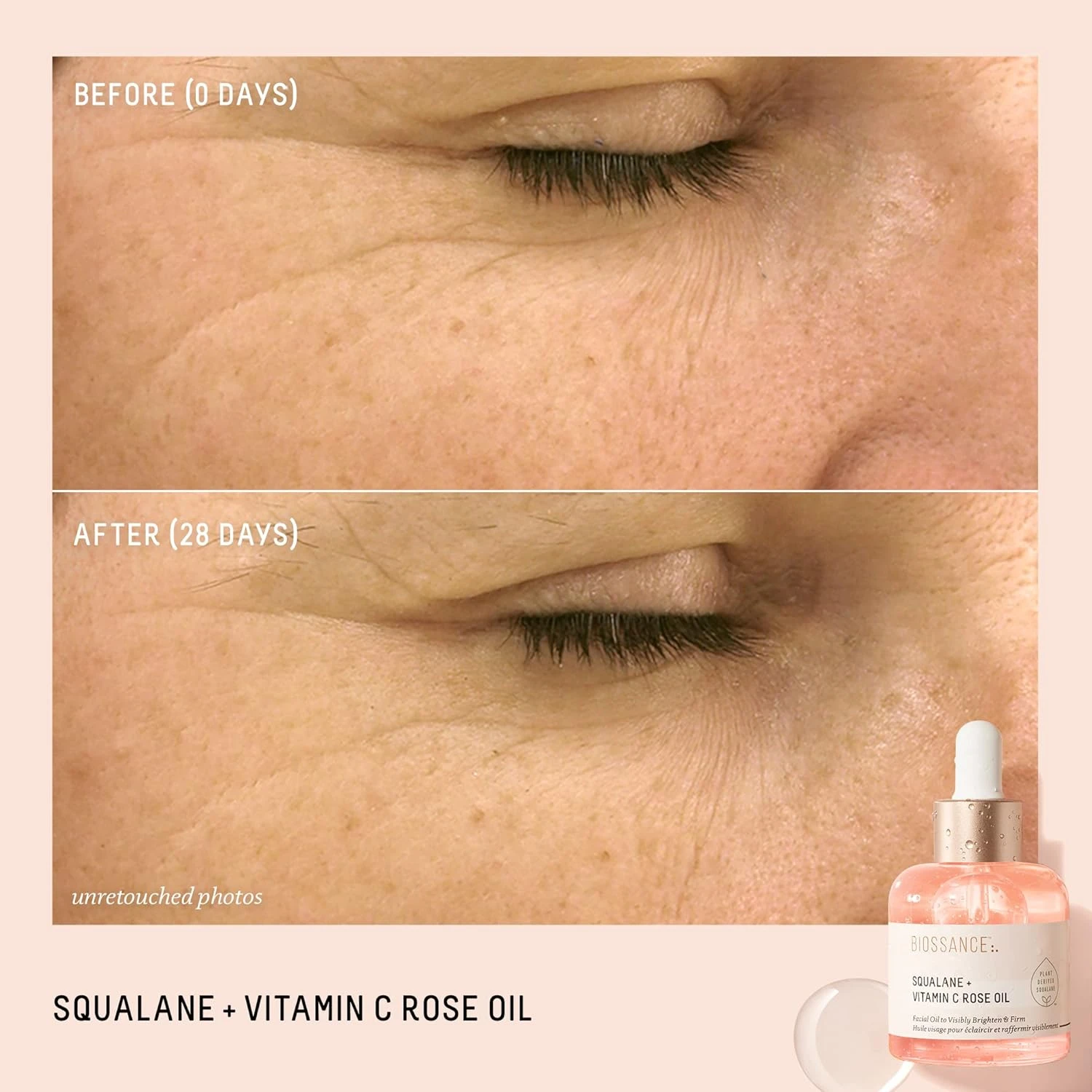 BIOSSANCE Squalane and Vitamin C Rose Oil. Facial Oil to Visibly Brighten, Hydra