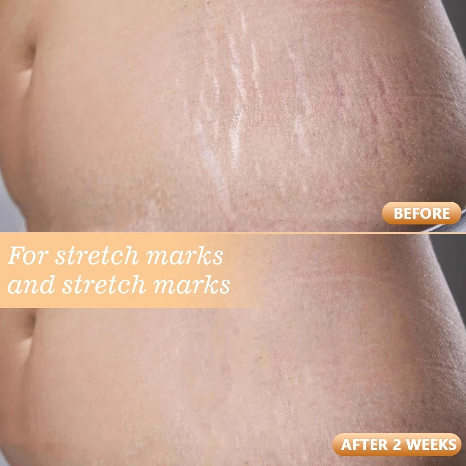 Nigwedete Magic Body Oil | Vitamin Massage Oil for Glowing Skin | with Jojoba, C