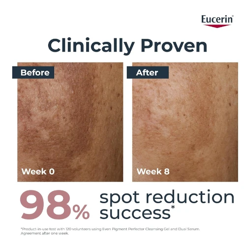 Eucerin Even Pigment Perfector Dual Face Serum Cream, Reduces Pigment Spots, Plu