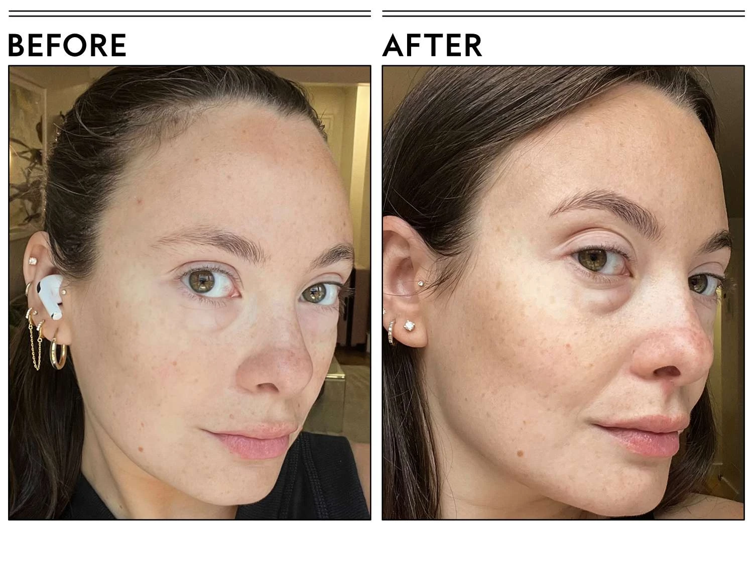 The Ordinary Original Natural Moisturising Factors + HA | 100 ml | The Original 