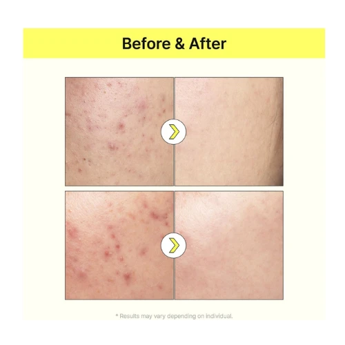 TIA'M Vita B3 Source, Niacinamide Serum, 10% Niacinamide (Vitamin B3), 2% Arbuti