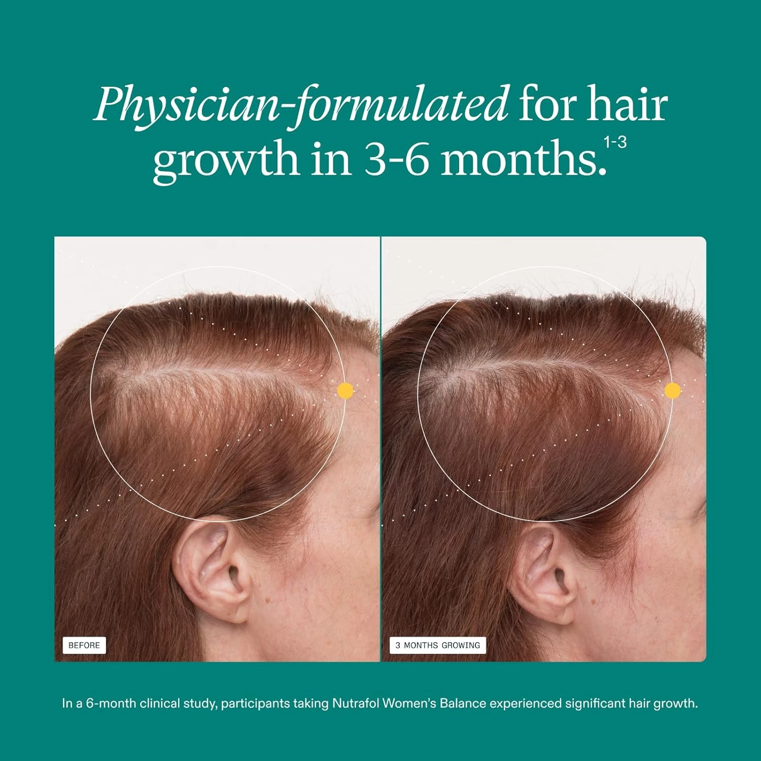 Nutrafol Women's Balance Hair Growth Supplements, Ages 45 and Up, Clinically Pro