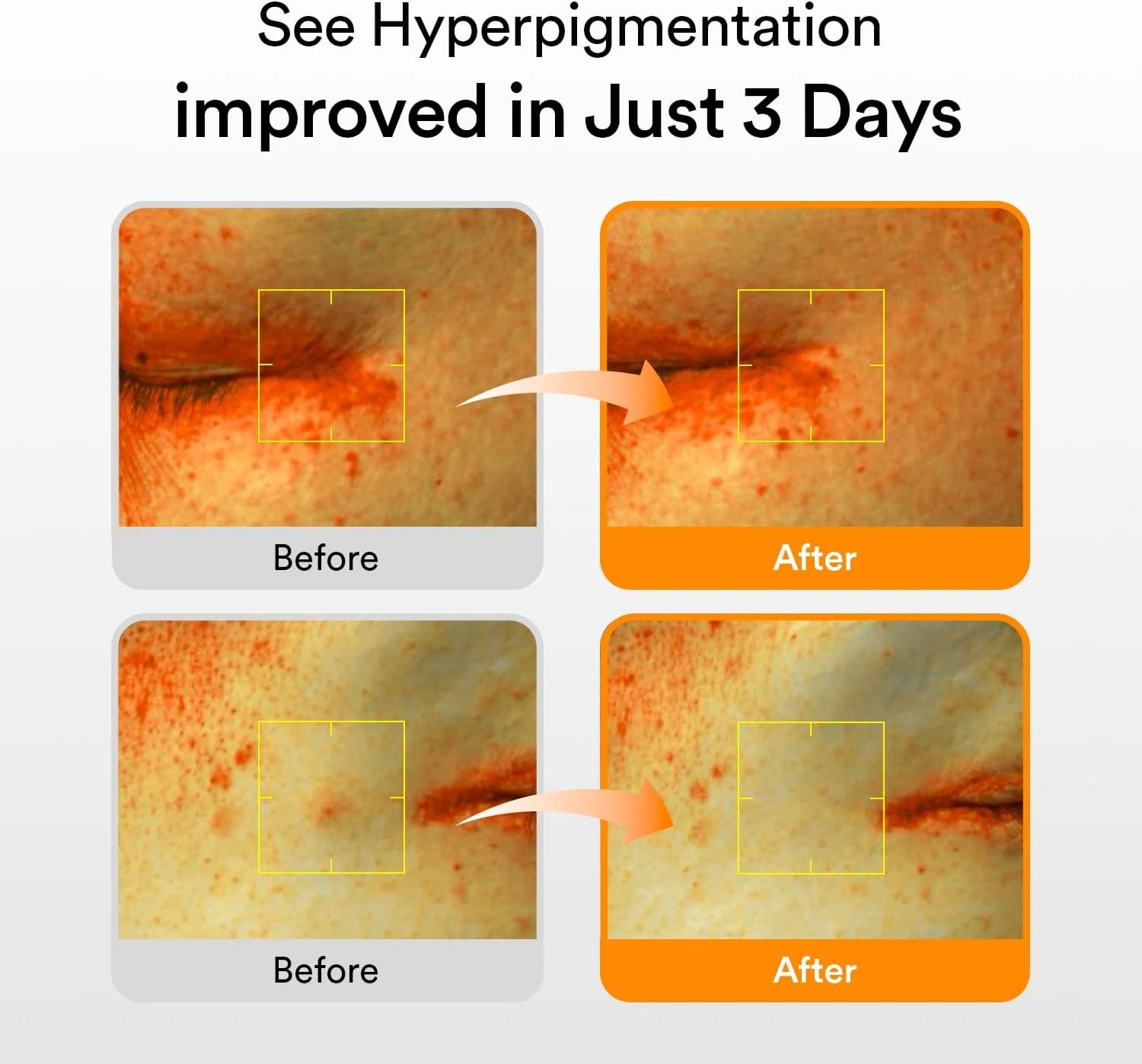 Abib Glutathiosome Dark Spot Serum Vita drop 1.69 fl.oz. | Korean Skincare, Dark