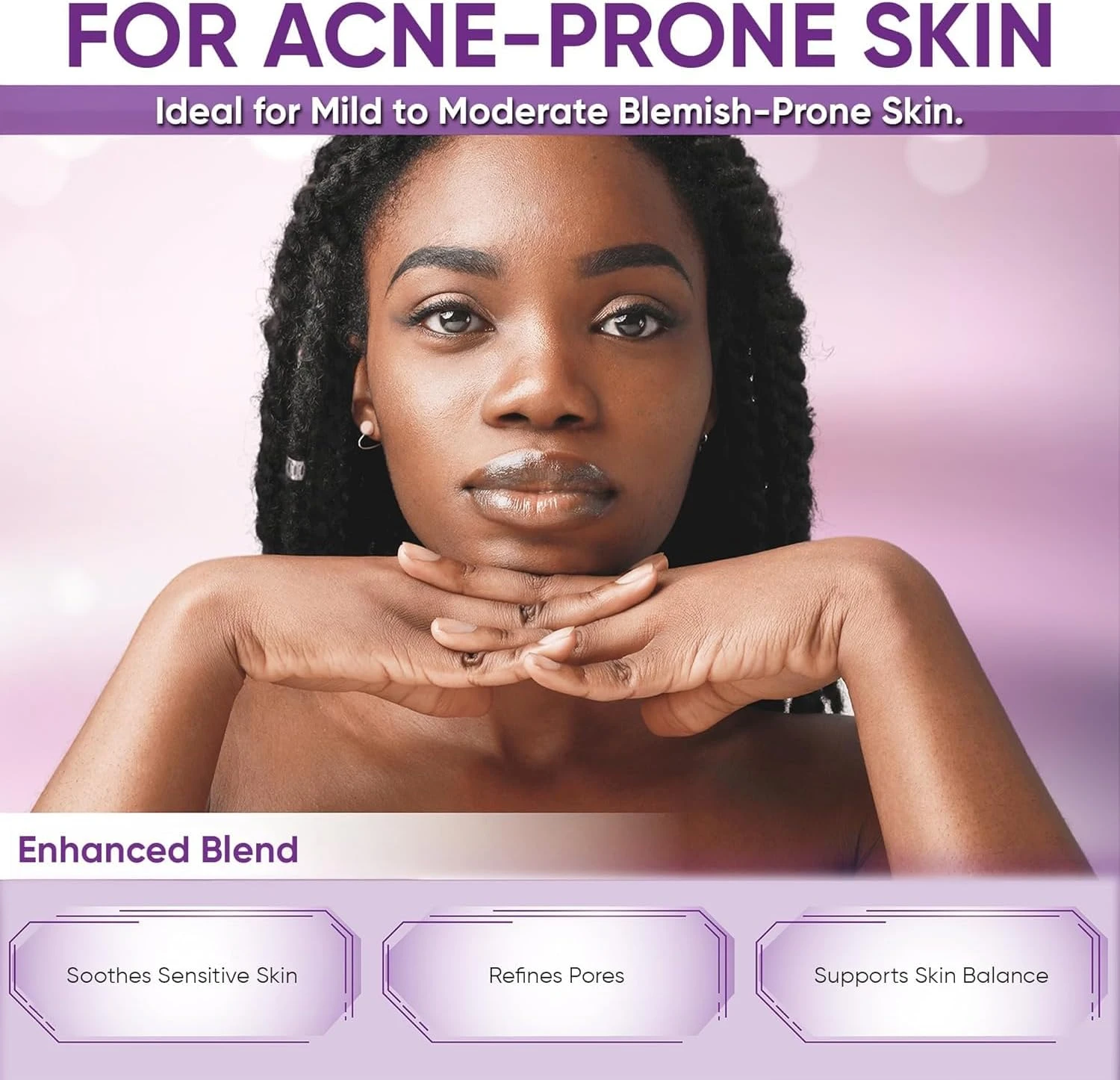 Nigwedete丨14% Azelaic Acid Acne Cream丨Advanced Azelaic Acid Serum丨Redness Relief