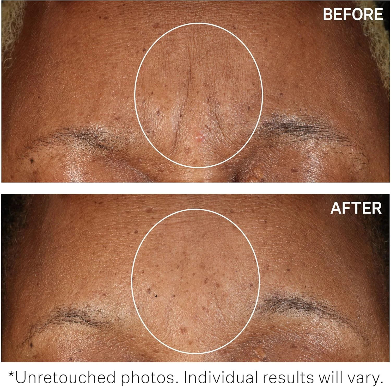 Strivectin Sd Advanced Plus Intensive Moisturizing Concentrate, Marine Fragnance