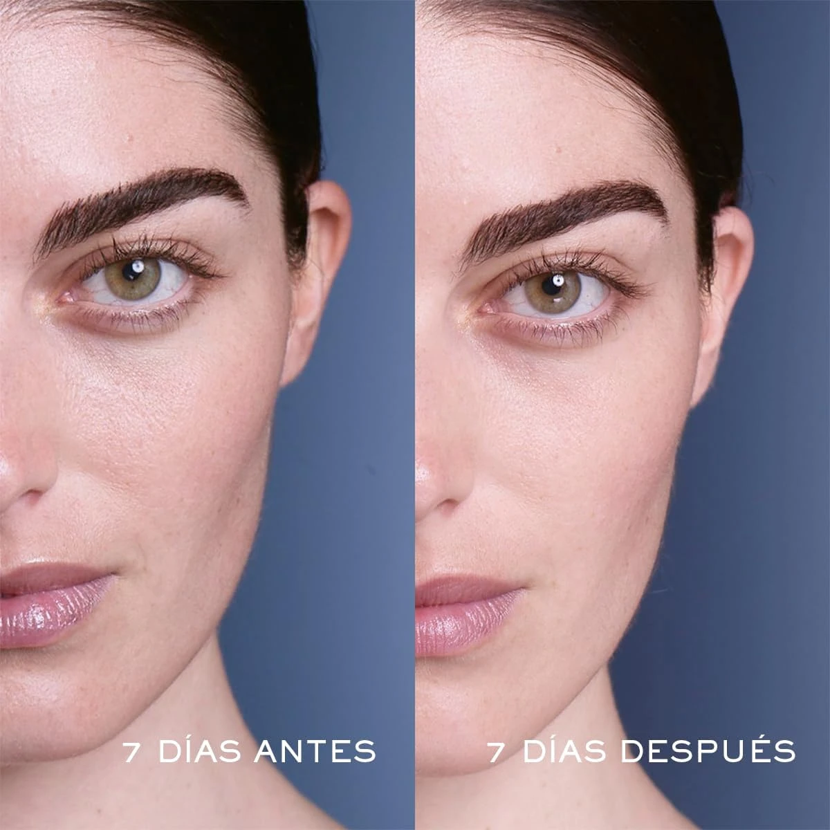 Lancome Genifique Advanced Youth Activating Concentrate (New Version) 30ml/1oz