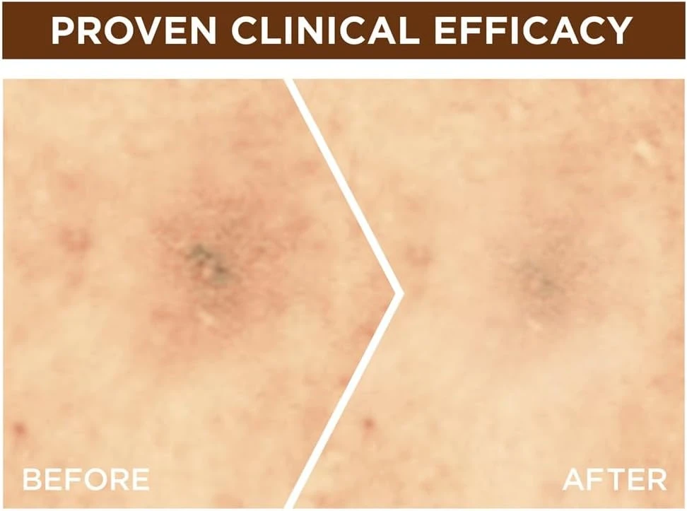 Garnier Skin Active Fast Bright Overnight Booster Face Serum with 10% Pure Vitam