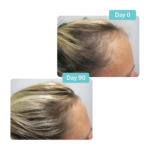Customer photo