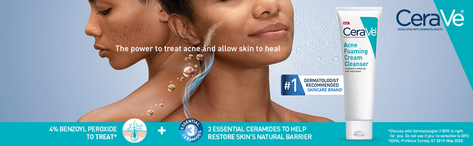CeraVe Acne Foaming Cream Cleanser, 5 Fl Oz (Pack of 1), Packaging may Vary banner 1