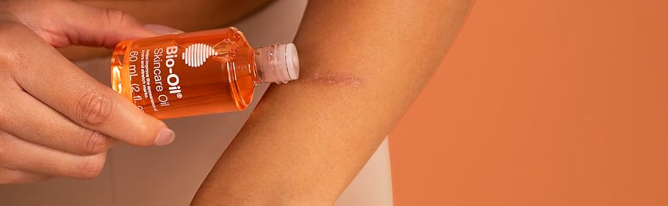 Bio-Oil Skincare oil| Specialist for Scar and Stretch marks,Uneven Skin tone, Ag banner 4