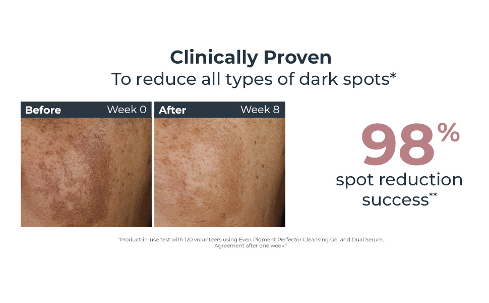 Eucerin Even Pigment Perfector Dual Face Serum Cream, Reduces Pigment Spots, Plu banner 2
