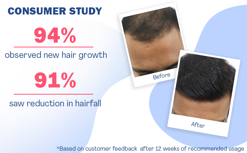 WishCare Hair Growth Serum Concentrate - 3% Redensyl, 4% Anagain, 2% Baicapil, C banner 2
