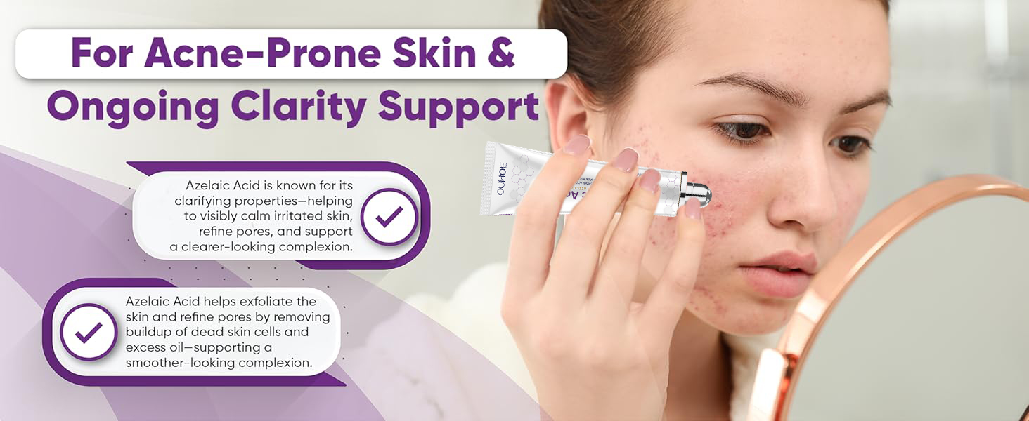 Nigwedete丨14% Azelaic Acid Acne Cream丨Advanced Azelaic Acid Serum丨Redness Relief banner 2